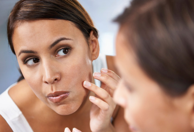 7 cuidados antiacné y seborreguladores