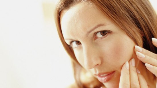 Consejos para evitar el acné adulto