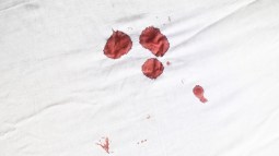 Trucos para quitar las manchas de sangre