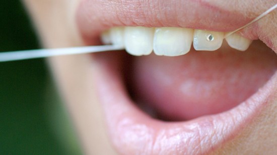 ¿Realmente es bueno usar hilo dental?