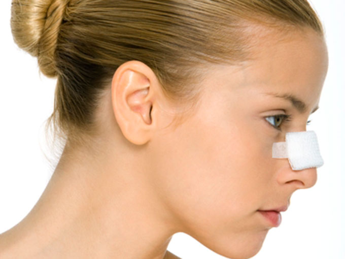 Motivos del sangrado de nariz