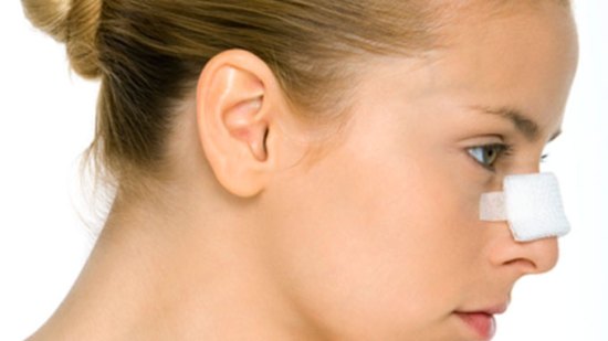 Motivos del sangrado de nariz