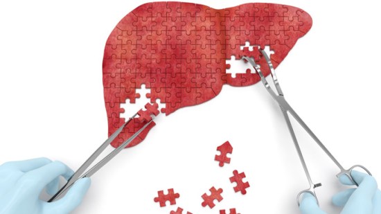 dieta piedras vesicula