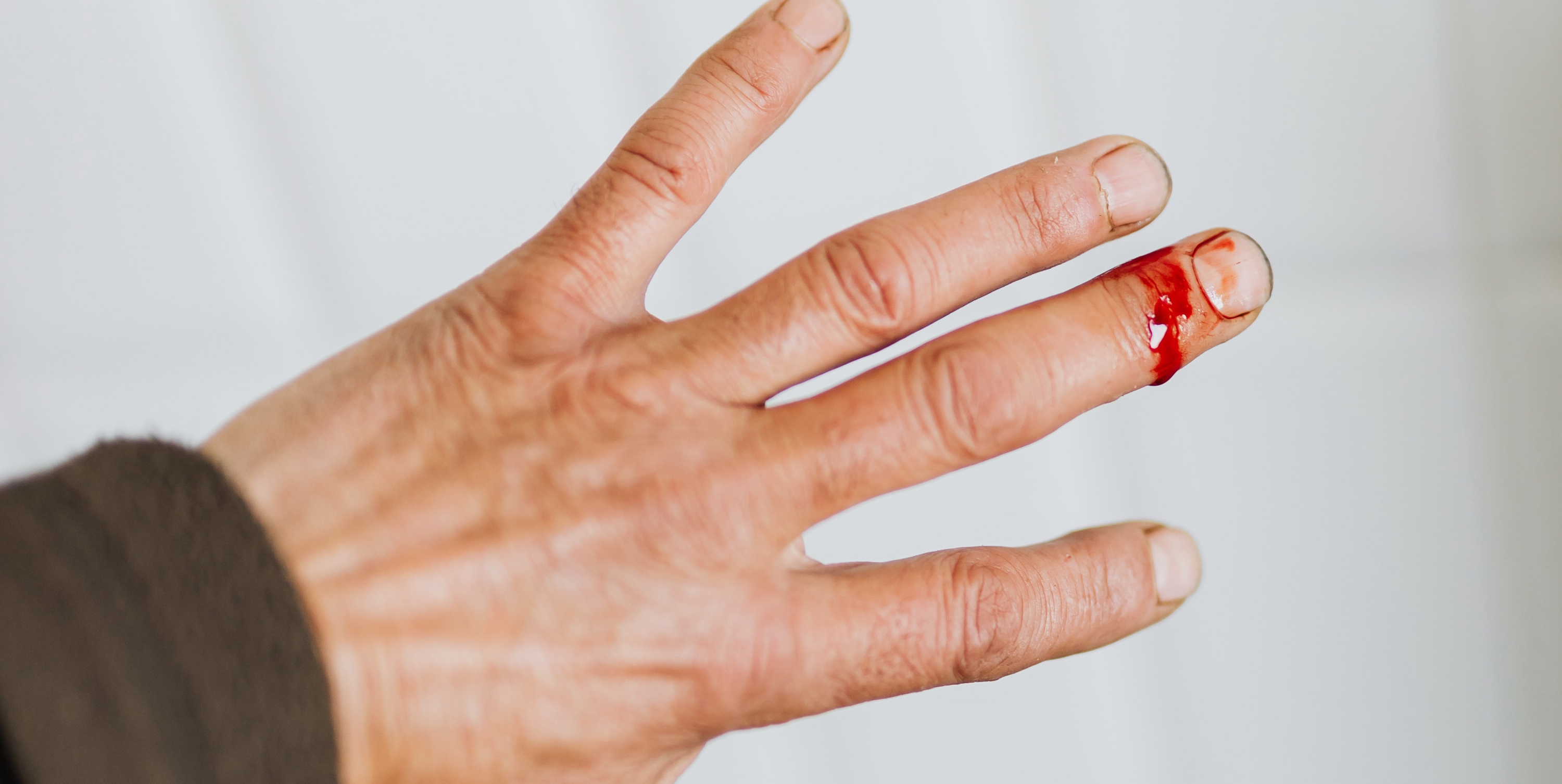 Heridas en casa médico