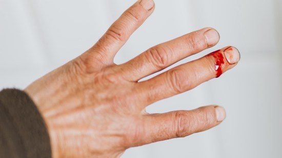 Heridas en casa médico